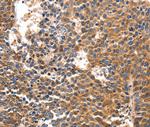 IRF1 Polyclonal Antibody