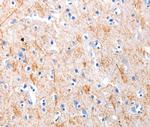 KISS1 Polyclonal Antibody