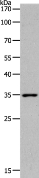 MC2R Polyclonal Antibody