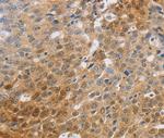 MCT2 Polyclonal Antibody