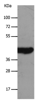 MCT2 Antibody in Western Blot (WB)