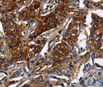 MRP5 Polyclonal Antibody