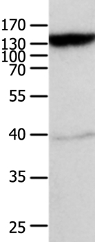 MRP5 Antibody in Western Blot (WB)