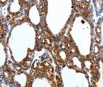MTNR1A Polyclonal Antibody