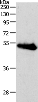 RBMS3 Antibody in Western Blot (WB)