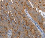 SLC34A2 Polyclonal Antibody