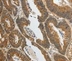 SPAG4L Polyclonal Antibody