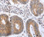 PSPN Polyclonal Antibody