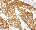 TMSB10 Antibody in Immunohistochemistry (Paraffin) (IHC (P))