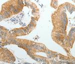 PGBD5 Polyclonal Antibody