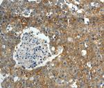 MRP7 Antibody in Immunohistochemistry (Paraffin) (IHC (P))