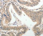ADAMTS2 Antibody in Immunohistochemistry (Paraffin) (IHC (P))