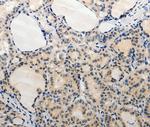 ADAMTS6 Polyclonal Antibody