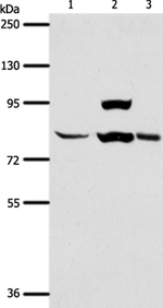 AGAP1 Antibody in Western Blot (WB)