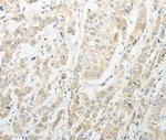 CCP4 Polyclonal Antibody