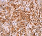 LPCAT4 Polyclonal Antibody