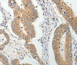 AKAP1 Antibody in Immunohistochemistry (Paraffin) (IHC (P))