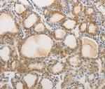 AKAP1 Antibody in Immunohistochemistry (Paraffin) (IHC (P))