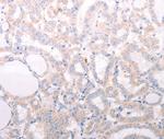 ANKRA2 Polyclonal Antibody