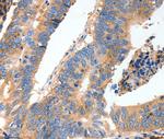 MUC6 Polyclonal Antibody