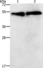 TACR2 Antibody in Western Blot (WB)