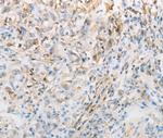 CNP Polyclonal Antibody