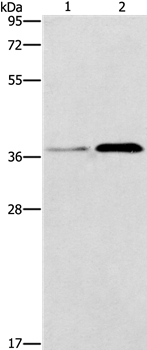 PAFAH2 Antibody in Western Blot (WB)