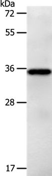 LPPR5 Polyclonal Antibody