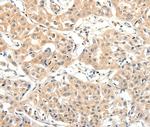 SLC27A1 Polyclonal Antibody