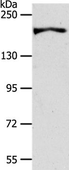 AKAP12 Antibody in Western Blot (WB)