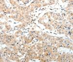 SV2A Antibody in Immunohistochemistry (Paraffin) (IHC (P))
