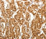 TNN Polyclonal Antibody