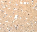 Tenascin X Antibody in Immunohistochemistry (Paraffin) (IHC (P))