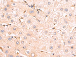 RARRES1 Antibody in Immunohistochemistry (Paraffin) (IHC (P))