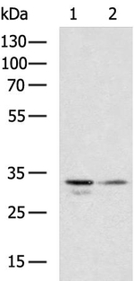 RARRES1 Antibody in Western Blot (WB)