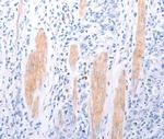 EDG4 Polyclonal Antibody
