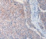 FAT4 Polyclonal Antibody