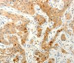 FAT4 Antibody in Immunohistochemistry (Paraffin) (IHC (P))