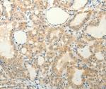FAT3 Antibody in Immunohistochemistry (Paraffin) (IHC (P))