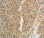 FAT3 Polyclonal Antibody