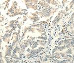 FZD8 Polyclonal Antibody