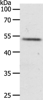 RXFP3 Antibody in Western Blot (WB)