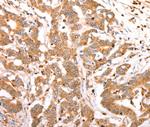 CELSR2 Polyclonal Antibody