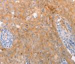 ABCA2 Polyclonal Antibody