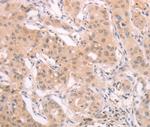 ADAM11 Polyclonal Antibody