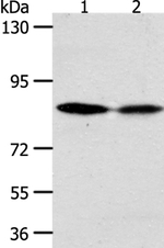 ADAM11 Antibody in Western Blot (WB)