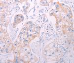 ADAMTS14 Polyclonal Antibody