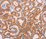 ADAMTS17 Polyclonal Antibody