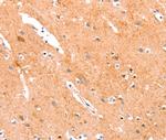 ANKZF1 Antibody in Immunohistochemistry (Paraffin) (IHC (P))