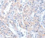 ARHGEF6 Polyclonal Antibody